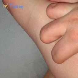 TheQu33nOfAmputations