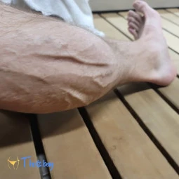 Tommy Calves