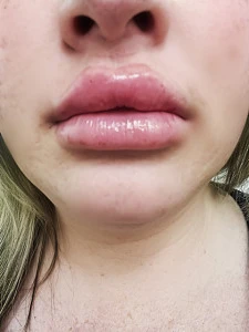 DSL 🫦 Kennedi OG 🍩🍆💦